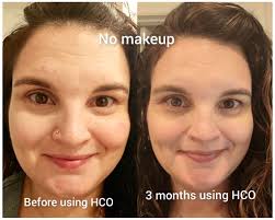 What helps with cortisol, bloating, and fatigue?