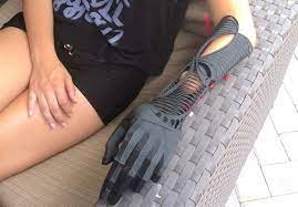 Student Designer Creates Beautiful 3d Printed Prosthetics Prosthetics Design Student Orthotics And Prosthetics