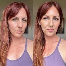 What are some tips for a face lift without surgery?