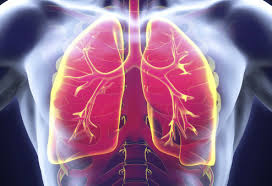 As cancer develops, these symptoms may become more severe or intense. First Kras Blocking Drug Approved For Advanced Lung Cancer Cancer Health