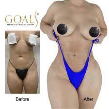 Fiala is particularly noted for his expertise in facelift, cosmetic breast augmentation, and body contouring. Goals Aesthetics Plastic Surgery 325 Photos 123 Reviews Cosmetic Surgeons 251 W 135th St New York Ny United States Phone Number Yelp