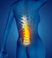 Lumbar spinal stenosis Images - Free Download on Freepik