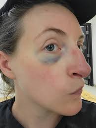 What surprises moms during pregnancy?