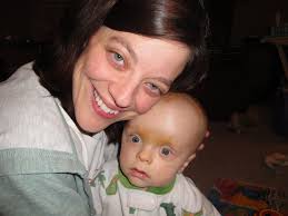 Krabbe warrior family conference weekend in Chicago