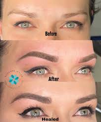 Profile for Suzanne Wylde Permanent Cosmetics & Medical Micropigmentation