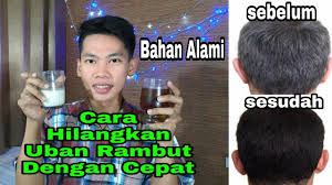Liputan6.com, jakarta lazimnya orang indonesia memiliki rambut yang berwana hitam atau gelap. Cara Hilangkan Uban Rambut Dengan Cepat Youtube