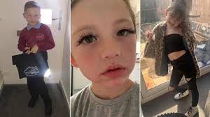 Prospective 8 Year Old Trans Girl Who Is Awaiting Doctor S Appointment To Change His Gender Attempted To Cut Off Her Penis At 3 And Now Wears Female Clothes To School Akahi News