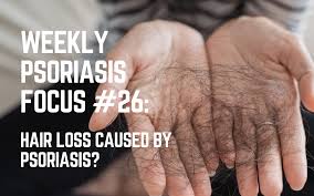 Maybe you would like to learn more about one of these? Weekly Psoriasis Focus 26 Hair Loss Caused By Psoriasis Psoriasis Treatments