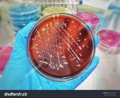 Image result for Rhodococcus equi