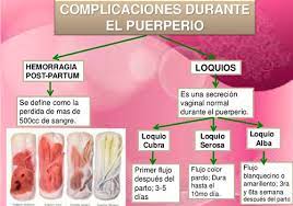 Las Mejores Compresas Post Parto Blog