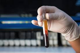 Why is the blood pressure being checked 20x per day? Warfarin Side Effects Bleeding Gangrene Health Risks