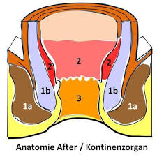 Sich knoten oder verhärtungen in der brust ertasten lassen, beim anheben der arme die brüste unterschiedlich fallen, eine brustwarze nach innen gezogen ist, veränderungen der haut an der brust oder der brustwarze auftreten, an einer brustwarze blutige, eitrige oder klare flüssigkeit austritt, Proktologe Nurnberg Klinik Hallerwiese De