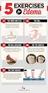 Water And Fluid Retention In Legs Progressivehealth Com Home Remedies For Diabetes Diabetes Remedies Swollen Feet Remedy