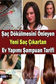 Evde Sac Dokulmesini Onleyen Sampuan Yapimi Evde Nasil Yapilir Sampuan Sac Sac Dokulmesi