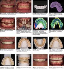 Periodic and comprehensive examination (012 & 011) Dentistry Can Change Lives Dentistry Today