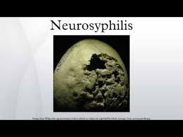 Image result for Neurosyphilis