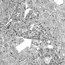 Image result for Silver Grey 1997 AAV