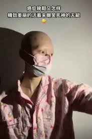 抗癌博主"给你一拳"去世患全球仅400例的罕见病|游民星空