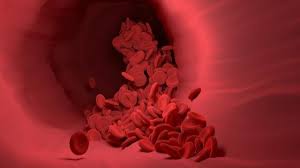 Misdiagnoses of colon cancer are surprisingly common, the daily mail reports. Gi Bleeding Often Mistaken As Side Effect Of Blood Thinners When It Could Indicate Cancer