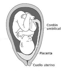 placenta praevia wikipedia