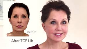 Plastic Surgery Beverly Hills