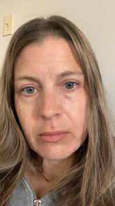 Tips to fade neck and chest discoloration