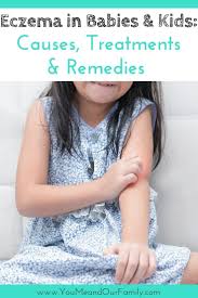 It may also start later in life in it is a very useful remedy for eczema which is crusty, moist, yellow and sticky; Coming Soon Home Remedies For Eczema Kids Eczema Remedies Baby Eczema