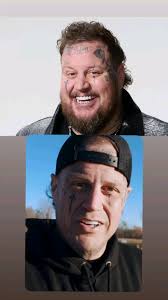 What is jelly roll hiding about his health?