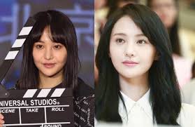 A lot of people compared zheng shuang's injections to angelababy. Plastic Surgery Fail Zheng Shuang S Apples Of The Cheeks Are U Shaped Jaynestars Com