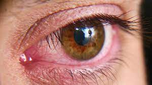Lysine is possibly safe for most people at recommended doses for up to one year. L Lysine Benefits The Right Dosage And Warnings 1md