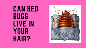 Sometimes, when i scratch, the areas bleed. Can Bed Bugs Live In Your Hair 10 Myths About Bed Bugs