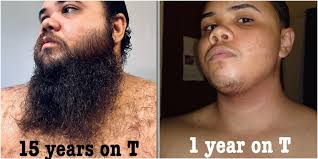 Celebrating a 10-year beard growth journey as a trans man