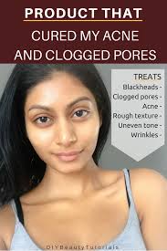 Product That Diminished My Acne And Clogged Enlarged Pores Uneven Skin Texture Uneven Skin Tone Remedies Skin Textures