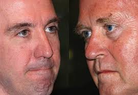 Primary voters to narrow field in Senate and Congressional races