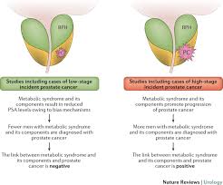 Although the percentage of cases in men is much lower than in women, male breast cancer accounts for a por. A Stage Dependent Link Between Metabolic Syndrome Components And Incident Prostate Cancer Nature Reviews Urology