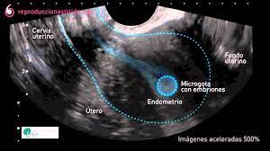 Movimientos Del Utero Youtube