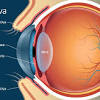 If you have an intraocular cancer, such as ocular melanoma, you might not have any. 1
