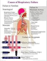 Causes Of Respiratory Failure Nursing School Survival Nurse Emt Study