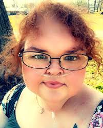 1000 Lb Sisters' Tammy Weight Loss Photos: Before and After