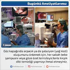 Goz Kapaginda Arpacik Ya Da Salazyon Yag Kisti Olusumunu Onlemek Icin Her Sabah Bebe Sampuani Veya Goze Ozel Temizleyicilerle Kirpik Dibi T Kirpik Yag Bilgi