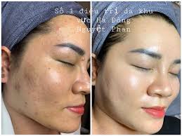 Nguyệt Phan Spa Số 4 Ngõ 30 Đường Lê Trọng Tấn Hà Đông Hà Nội