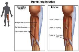 How are hamstring injuries treated? Physical Therapist S Guide To Hamstring Injuries