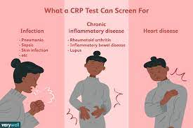 A simple blood test can be done to check your . C Reactive Protein Test Uses Side Effects Procedure Results