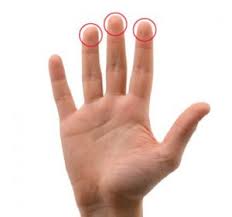 Berikutan pemeriksaan klinikal oleh seorang doktor, pesakit mungkin menjalani kaedah pengimejan yang berbeza dan dirujuk untuk ujian makmal. Buat Pemeriksaan Sendiri Payudara Psp Ini Cara Caranya Untuk Kesan Kanser Peringkat Awal Di Rumah Nona