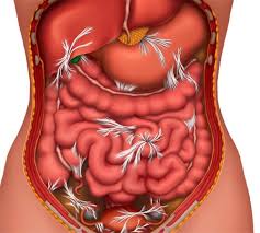 How to handle belly pain after colonoscopy? Bowel Obstruction