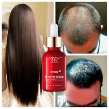 It can prevent hair fall by strengthening the roots of your hair and can improve the tensile strength. 1pcs Hair Growth Essence Anti Hair Loss Product Shampoo L Natural Hair Regrowth Fast Thicker Hair Growth Oil For Men And Women Hair Loss Products Aliexpress