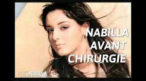 Tentant une carrière de mannequin durant son adolescence, elle apparaît à partir de 2011 dans des émissions. Nabilla Benattia Avant Chirurgie Nez Levre Youtube