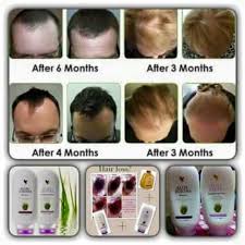 pin by samantha chong on forever solves your hair problems forever living aloe vera forever living products regrow hair