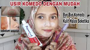 Cara Menghilangkan Komedo Dengan Cepat Dan Mudah Menggunakan Pastagigi Youtube