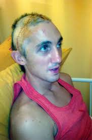 Bashed footballer not scared of 'cowards' who beat him